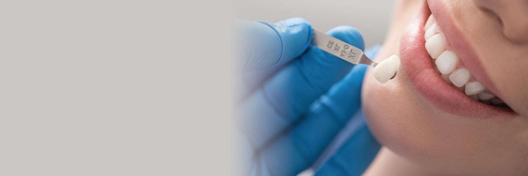 Cosmetic Dentistry | Dentist